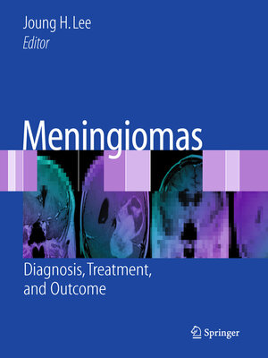 cover image of Meningiomas